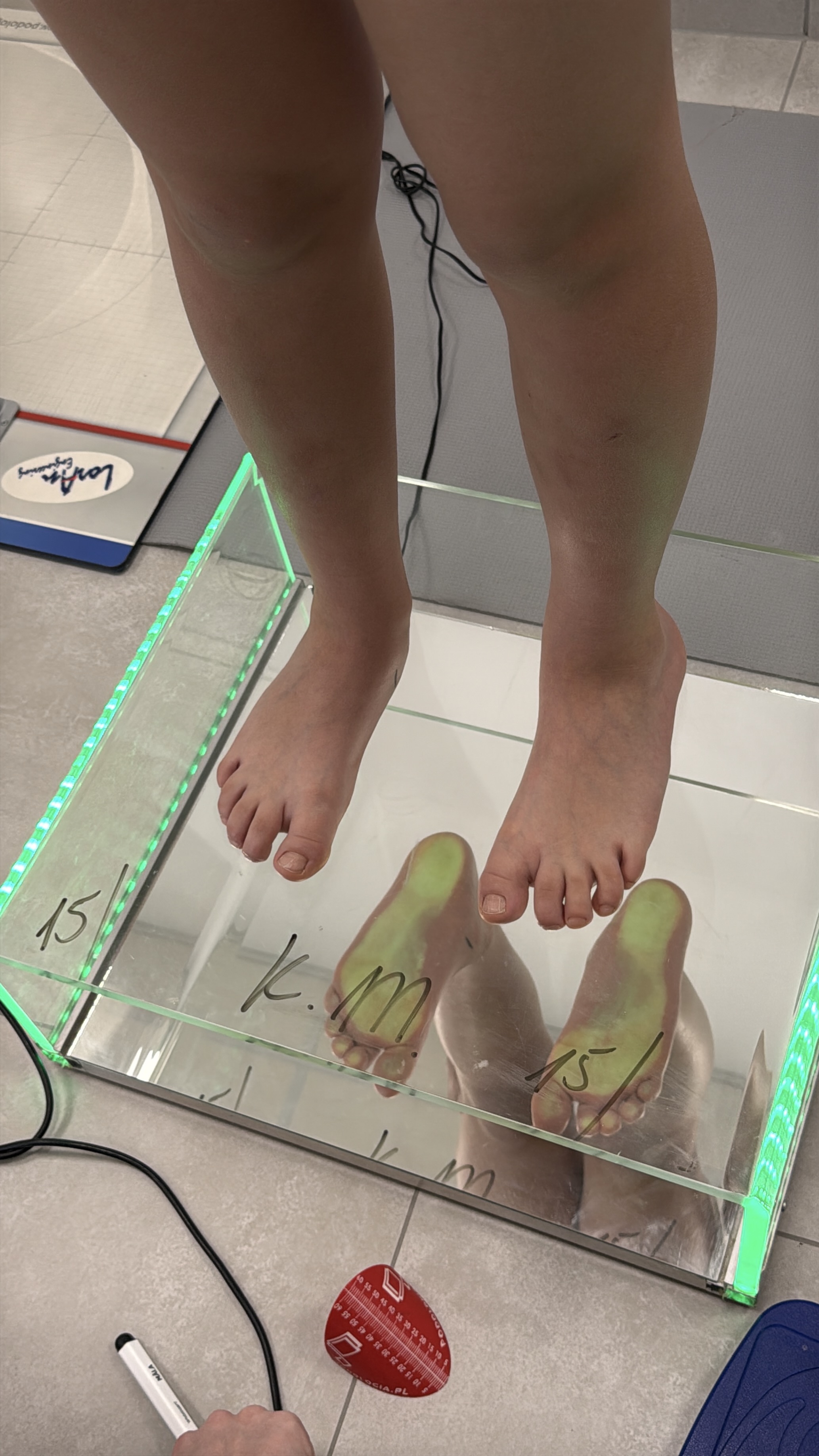 Pacjent na platformie podoskopowej podczas diagnostyki stóp