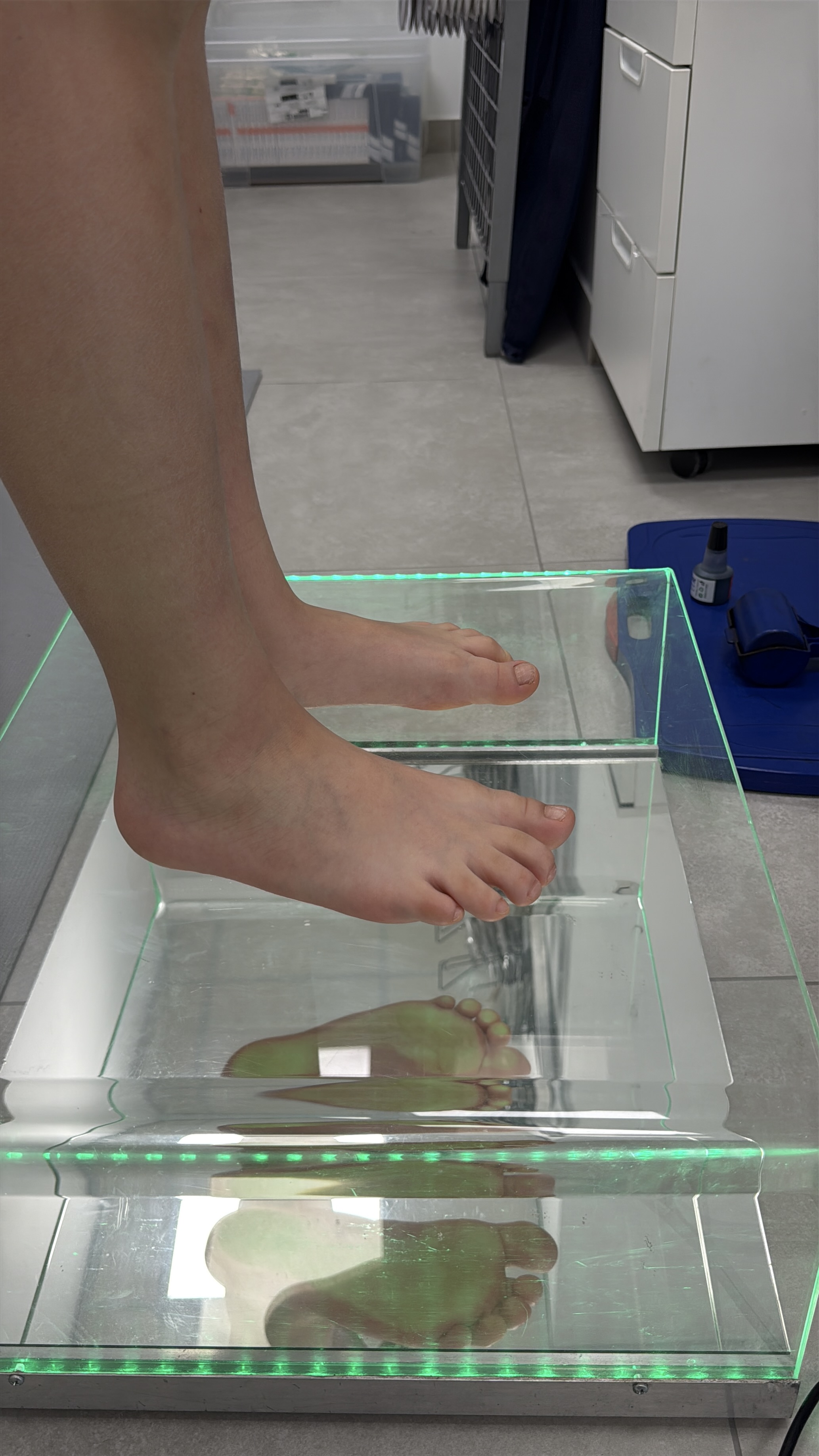 Ocena ustawienia stóp pacjenta w obciążeniu